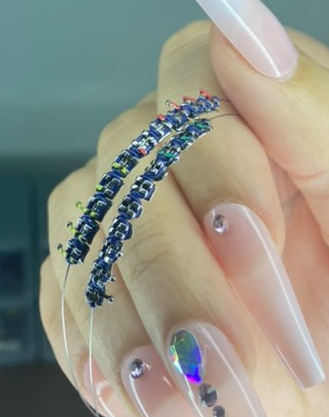 Customizable Regular Braces (CHOOSE YOUR OWN COLOR)