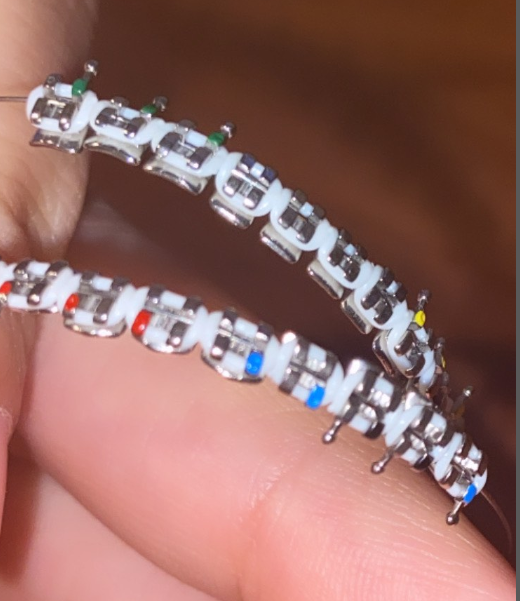 Customizable Regular Braces (CHOOSE YOUR OWN COLOR)
