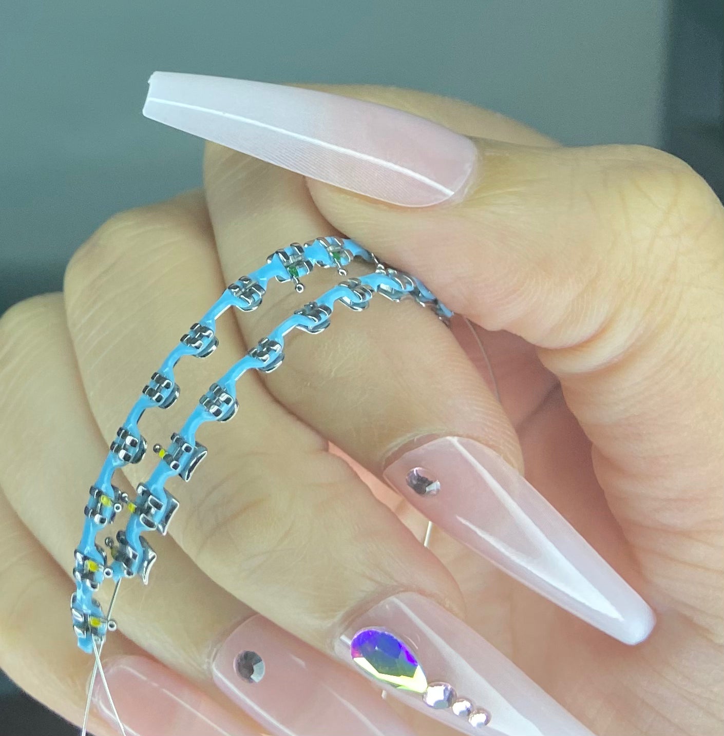 Customizable Power Chain Braces (CHOOSE YOUR OWN COLOR)