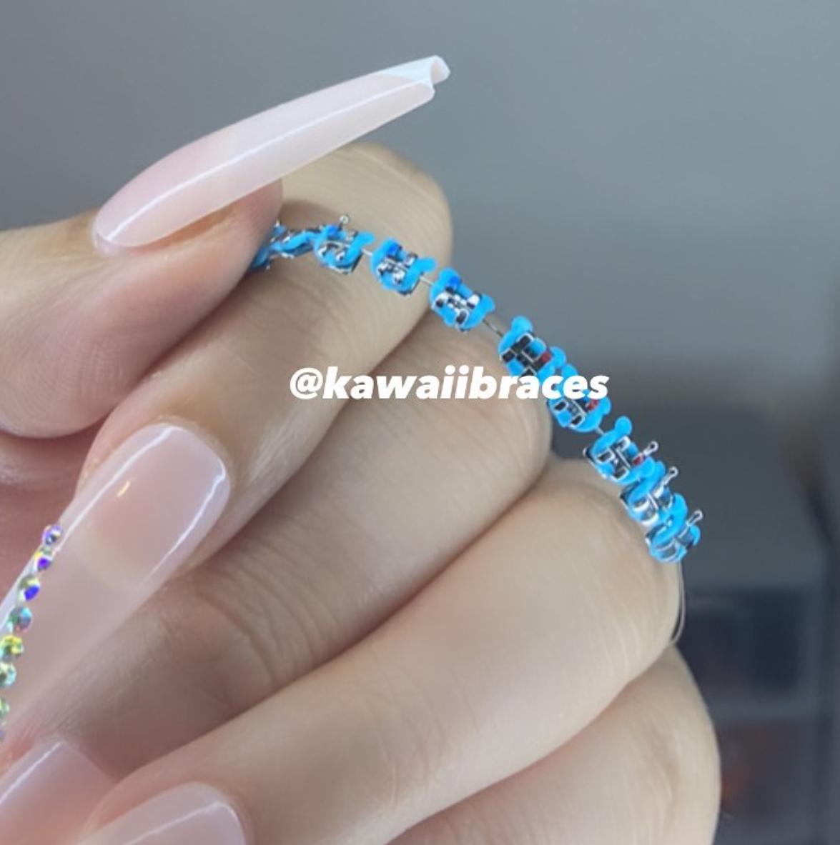 ❄️ Mickey Mouse Braces