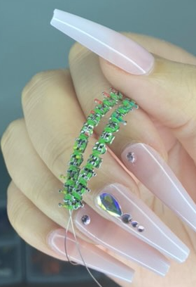 Regular Braces Lime Green 💚